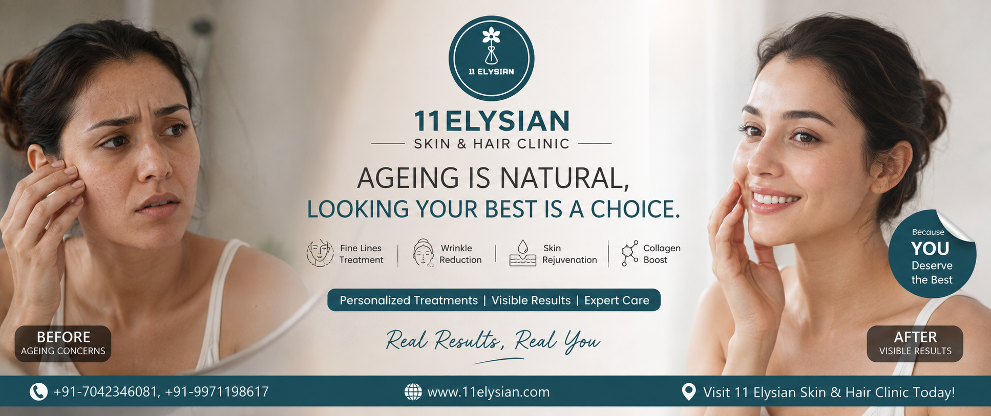 Anti-Ageing Treatment Near Gaur City 2, Greater Noida West